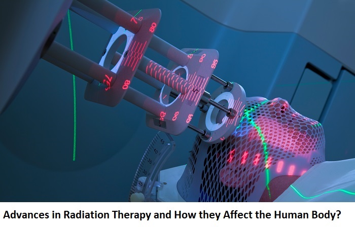 Advances in Radiation Therapy and How they Affect the Human Body Advances in Radiation Therapy and How they Affect the Human Body