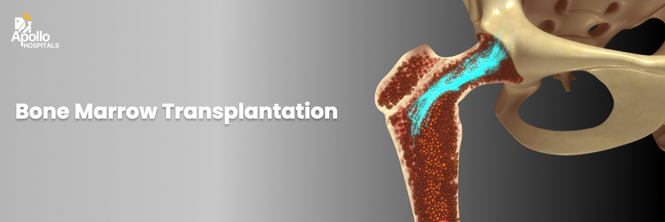 Bone Marrow Transplantation